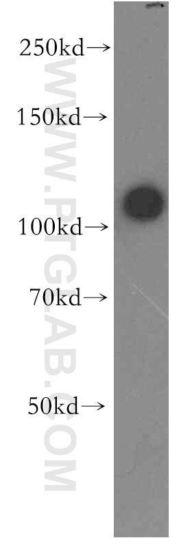 STAT2 western blot WB 16674-1-AP STAT2 Antibody ISGF-3; MGC59816; P113; STAT113