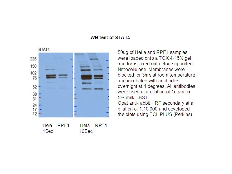 sas比stat_stat.s ixusr_proc/stat