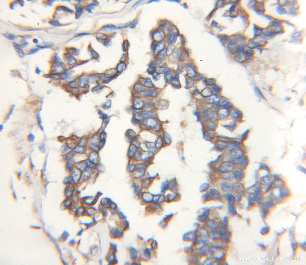 STC2 IHC Immunohistochemical 10314-1-AP STC2 Antibody STC-2; STCRP
