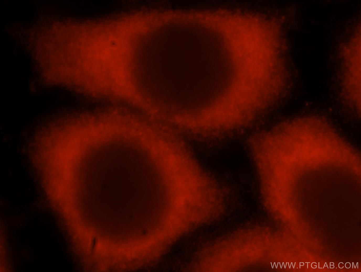 STEAP3 Immunofluorescence IF 17186-1-AP STEAP3 Antibody STMP3; TSAP6; dudlin-2