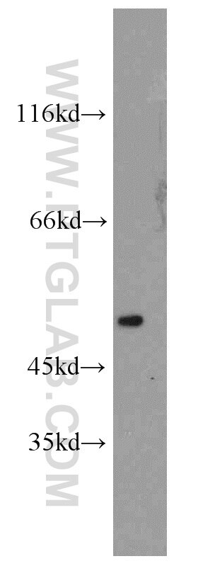 STEAP3 western blot WB 17186-1-AP STEAP3 Antibody STMP3; TSAP6; dudlin-2