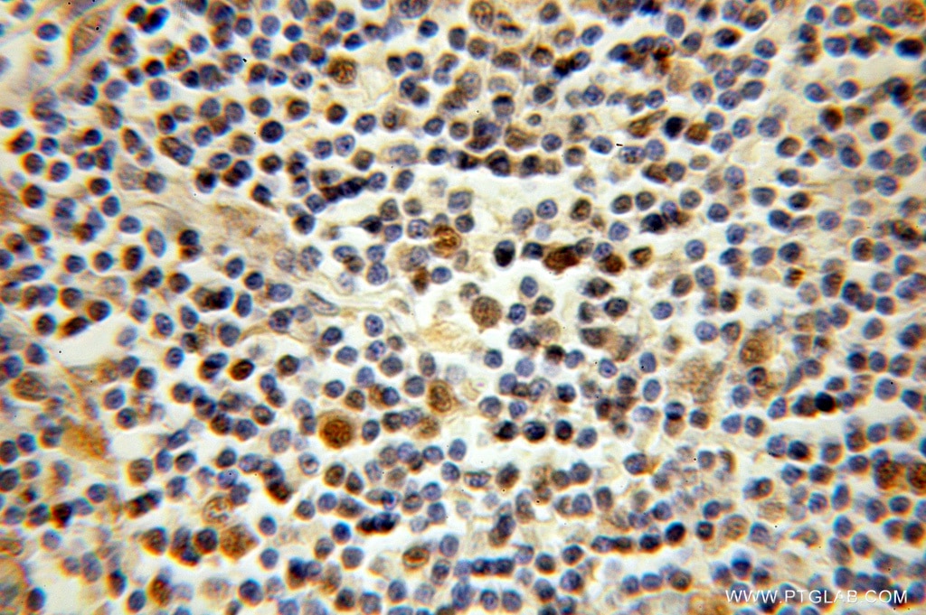 STK11 IHC Immunohistochemical 10746-1-AP STK11 Antibody LKB1; PJS