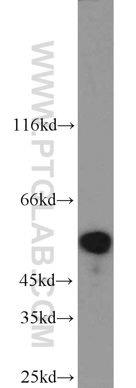 STK11 western blot WB 10746-1-AP STK11 Antibody LKB1; PJS