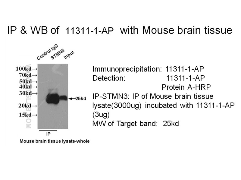 STMN3 IP 11311-1-AP STMN3 Antibody SCLIP