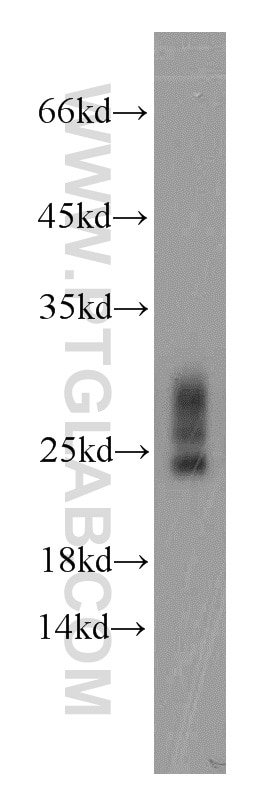 STMN3 western blot WB 11311-1-AP STMN3 Antibody SCLIP