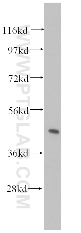 human kidney tissue were subjected to SDS PAGE followed by western blot with 11201-1-AP(STX16 Antibody) at dilution of 1:500 STX16 western blot WB 11201-1-AP STX16 Antibody MGC90328; SYN16; hsyn16