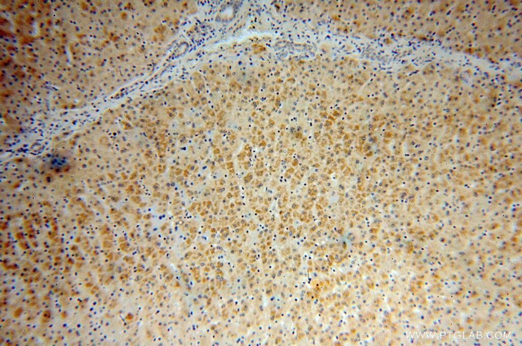 STX17 IHC Immunohistochemical 17815-1-AP STX17 Antibody FLJ20651; MGC102796; MGC126613; MGC126615