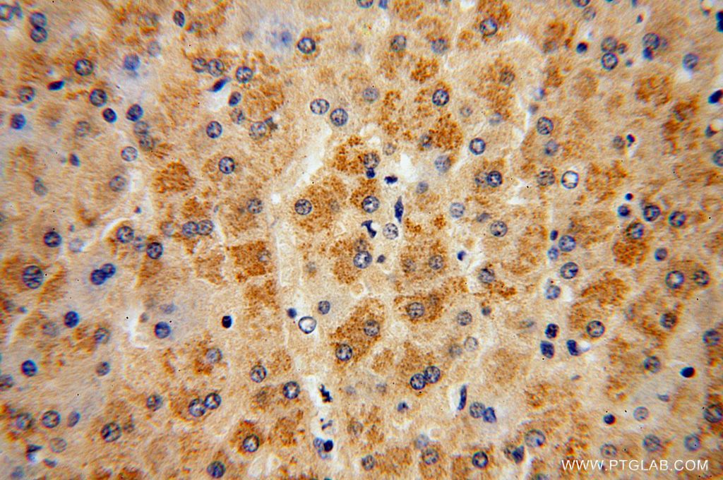 STX17 IHC Immunohistochemical 17815-1-AP STX17 Antibody FLJ20651; MGC102796; MGC126613; MGC126615