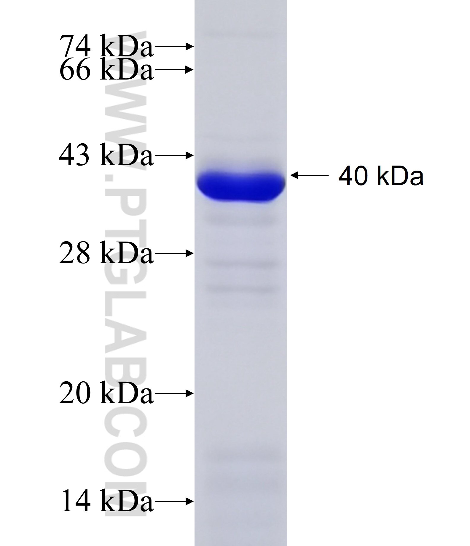 STX19 fusion protein ag11238 SDS-PAGE