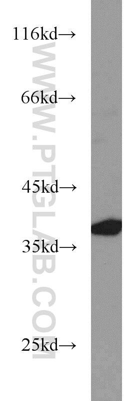 Jurkat cells were subjected to SDS PAGE followed by western blot with 14988-1-AP(STX4 Antibody) at dilution of 1:1500 STX4 western blot WB 14988-1-AP STX4 Antibody STX4A; p35-2