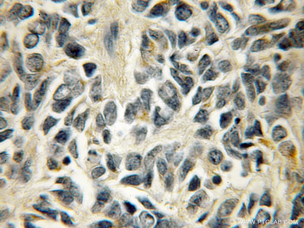 STX7 IHC Immunohistochemical 12322-1-AP STX7 Antibody 