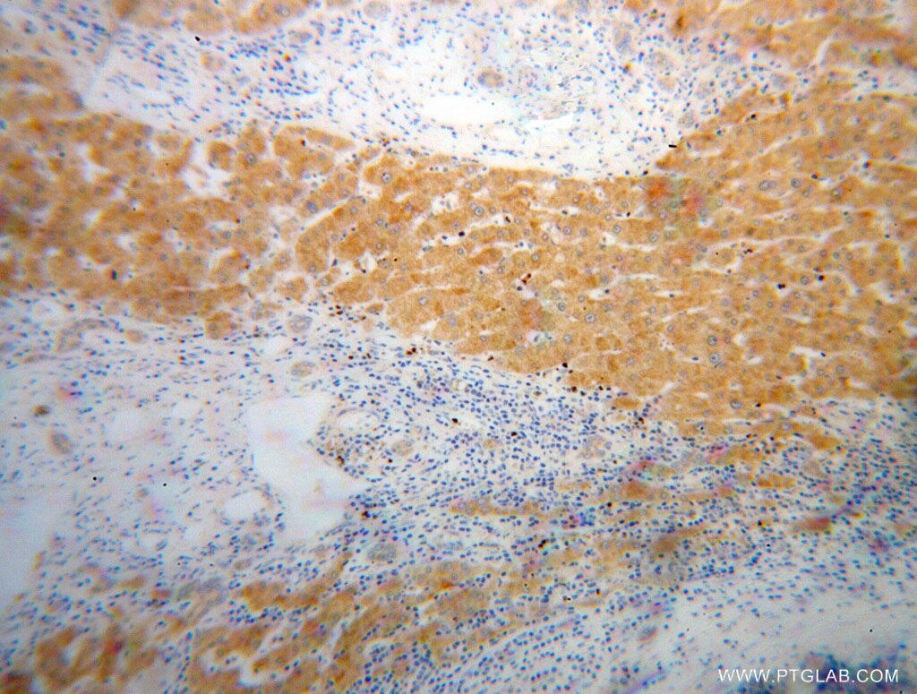 SUCLG1 IHC Immunohistochemical 14923-1-AP SUCLG1 Antibody FLJ21114; G-ALPHA; SUCLA1