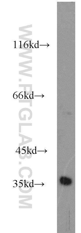 SUCLG1 western blot WB 14923-1-AP SUCLG1 Antibody FLJ21114; G-ALPHA; SUCLA1