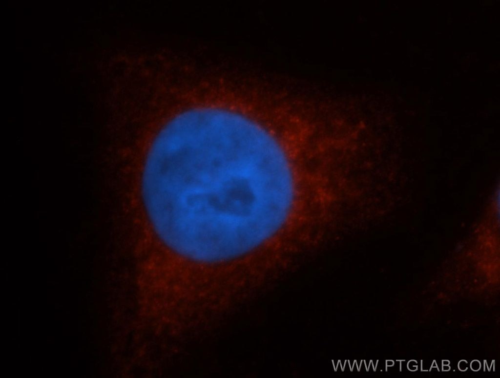 SULT1A1 Immunofluorescence IF 10911-2-AP SULT1A1 Antibody HAST1/HAST2; MGC131921; MGC5163; P-PST; PST; ST1A3; STP; STP1; TSPST1