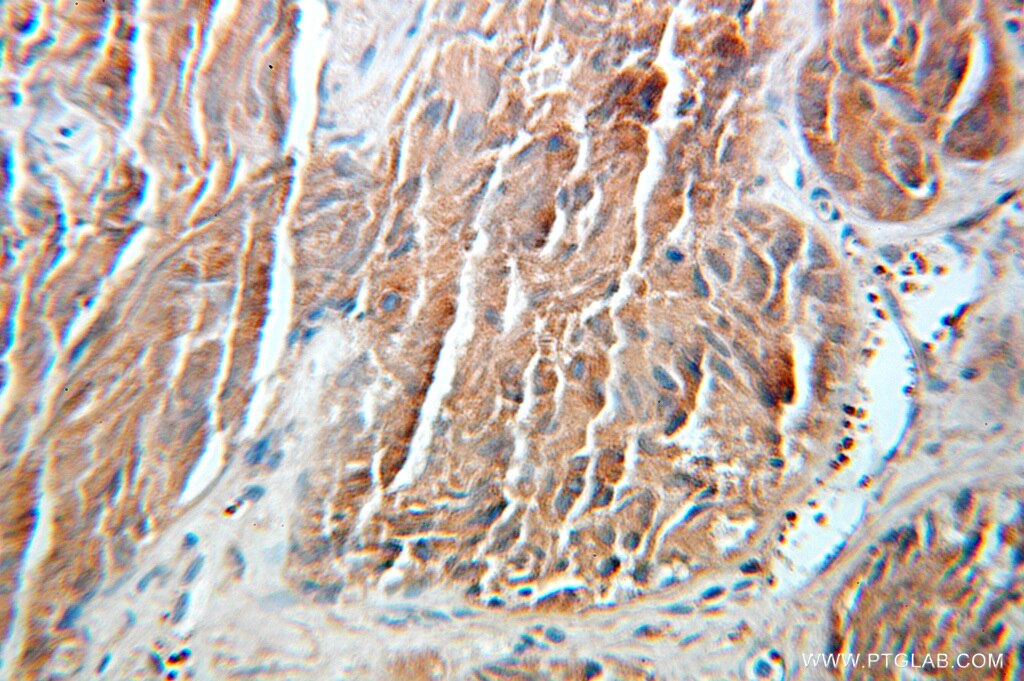 SULT1C2 IHC Immunohistochemical 10662-1-AP SULT1C2 Antibody ST1C1; ST1C2; SULT1C1; humSULTC2