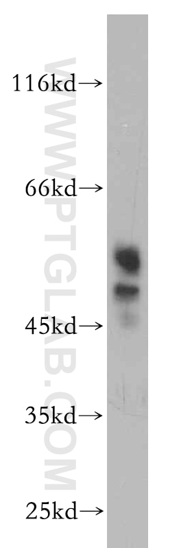 SH-SY5Y cells were subjected to SDS PAGE followed by western blot with 20472-1-AP(SYT4 Antibody) at dilution of 1:600 SYT4 western blot WB 20472-1-AP SYT4 Antibody HsT1192; KIAA1342