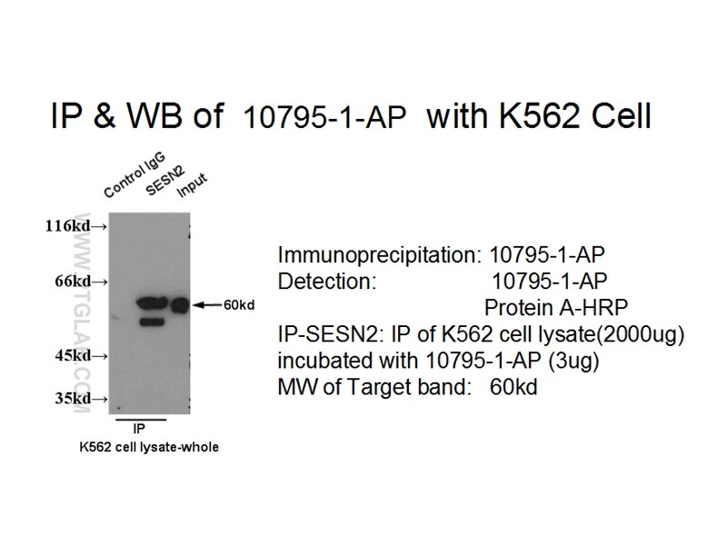 Sestrin2 IP 10795-1-AP Sestrin2 Antibody DKFZp761M0212; DKFZp761M02121; HI95; SES2; SEST2