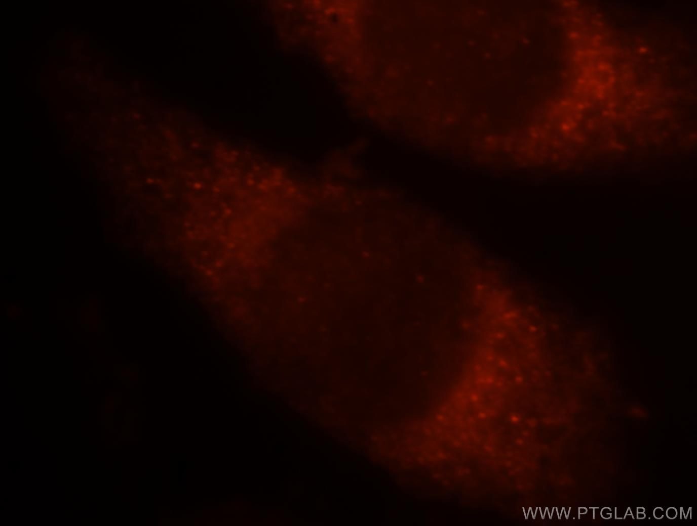 Sestrin2 Immunofluorescence IF 10795-1-AP Sestrin2 Antibody DKFZp761M0212; DKFZp761M02121; HI95; SES2; SEST2