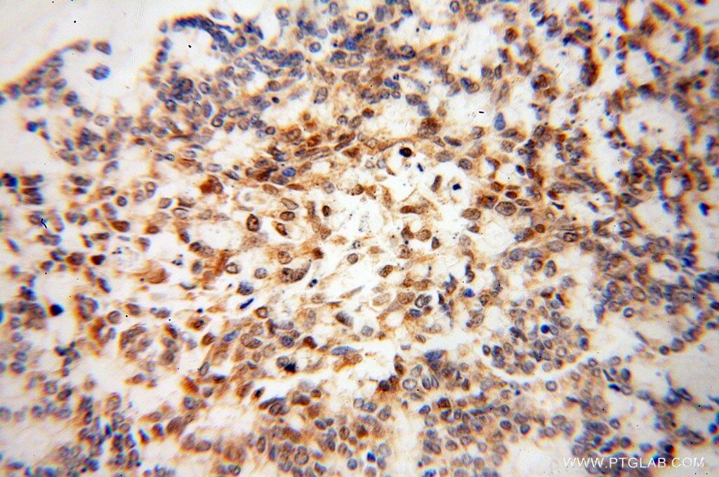 Sestrin2 IHC Immunohistochemical 10795-1-AP Sestrin2 Antibody DKFZp761M0212; DKFZp761M02121; HI95; SES2; SEST2