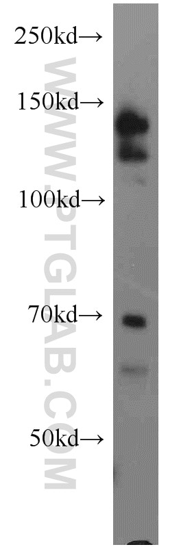 MCF7 cells were subjected to SDS PAGE followed by western blot with 13862-1-AP(TACC1 Antibody) at dilution of 1:1000 TACC1 western blot WB 13862-1-AP TACC1 Antibody DKFZp686K18126; FLJ42304; Ga55; KIAA1103