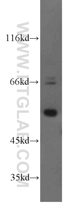 K-562 cells were subjected to SDS PAGE followed by western blot with 17367-1-AP(TADA2B Antibody) at dilution of 1:1000 TADA2B western blot WB 17367-1-AP TADA2B Antibody ADA2(beta); ADA2B; MGC21874