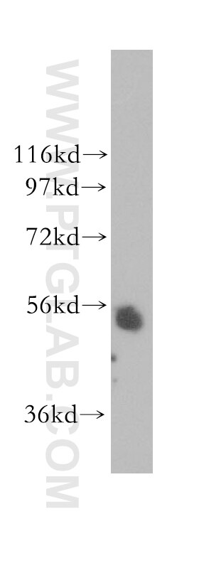 mouse testis tissue were subjected to SDS PAGE followed by western blot with 11299-1-AP(TADA2L Antibody) at dilution of 1:800 TADA2L western blot WB 11299-1-AP TADA2L Antibody ADA2; ADA2A; FLJ12705; KL04P; hADA2