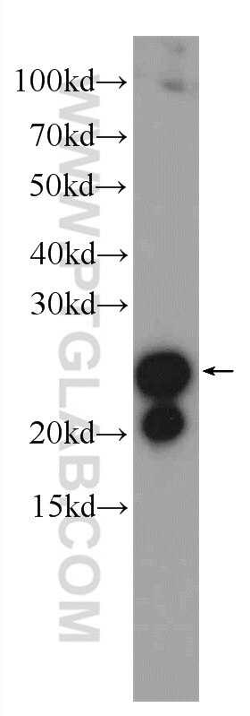 mouse colon tissue were subjected to SDS PAGE followed by western blot with 10493-1-AP(TAGLN Antibody) at dilution of 1:2000 TAGLN western blot WB 10493-1-AP TAGLN Antibody DKFZp686P11128; SM22; SMCC; TAGLN1; WS3-10