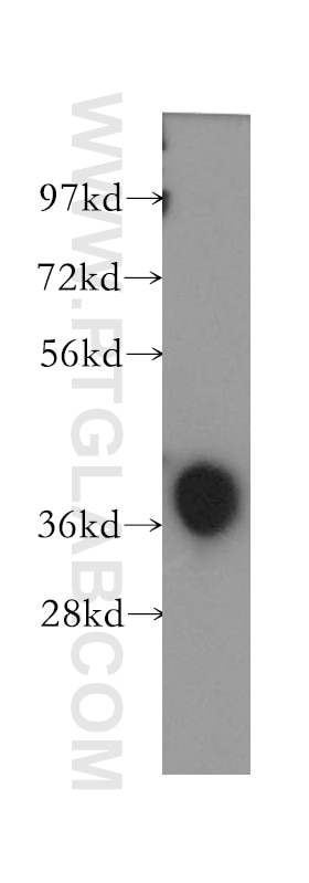 human brain tissue were subjected to SDS PAGE followed by western blot with 12376-1-AP(TALDO1 Antibody) at dilution of 1:1000 TALDO1 western blot WB 12376-1-AP TALDO1 Antibody TAL; TAL-H; TALDOR; TALH