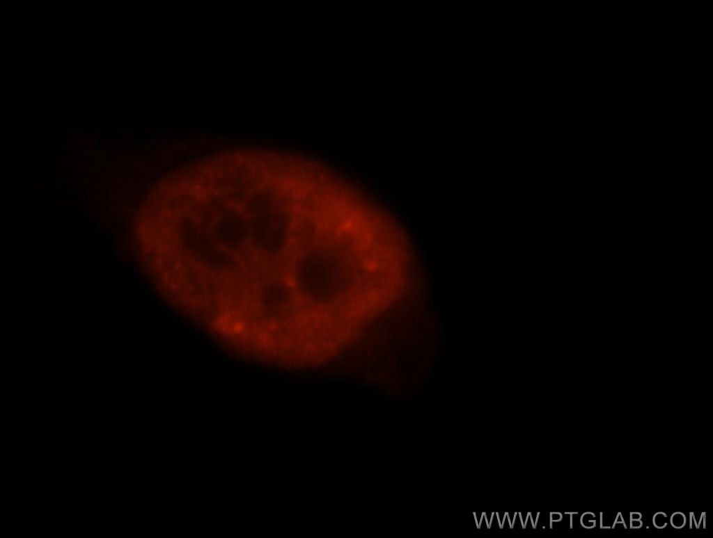 TARDBP Immunofluorescence IF 10782-2-AP TARDBP Antibody ALS10; TDP-43; Tdp43