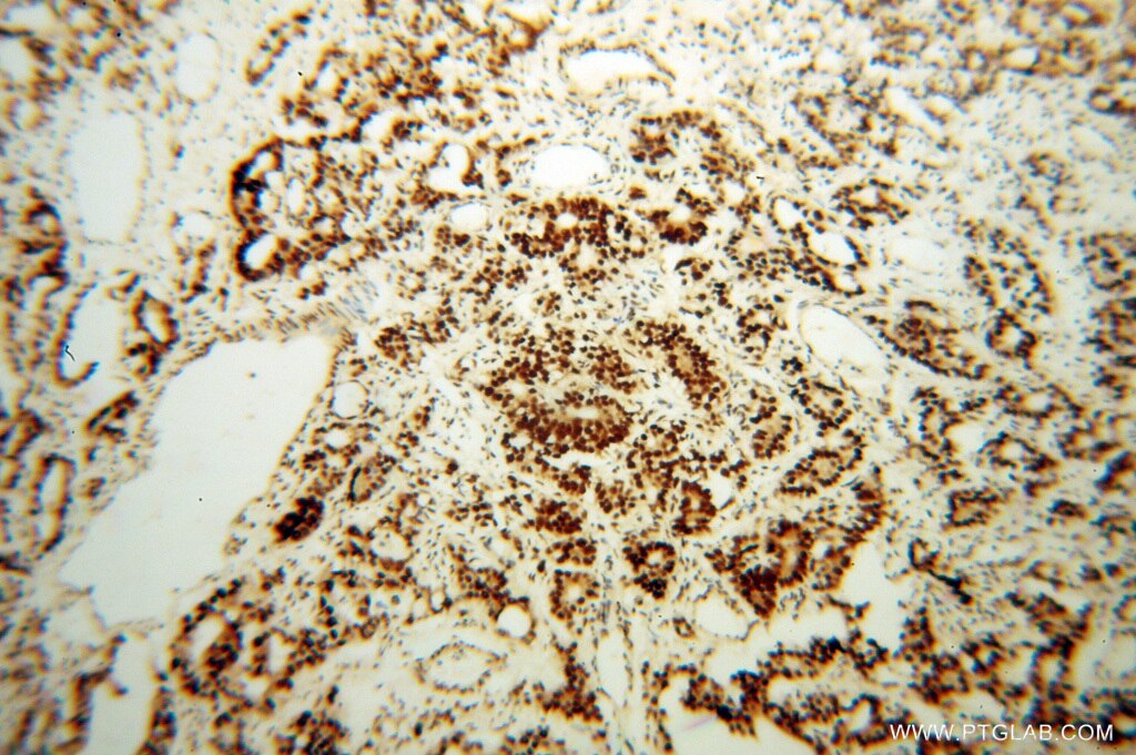 TARDBP IHC Immunohistochemical 10782-2-AP TARDBP Antibody ALS10; TDP-43; Tdp43