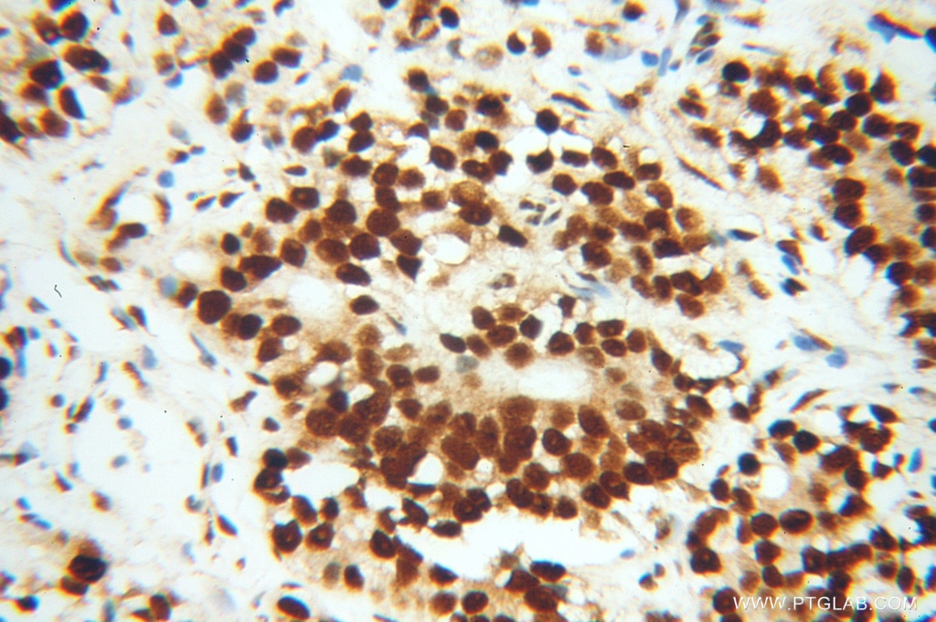 TARDBP IHC Immunohistochemical 10782-2-AP TARDBP Antibody ALS10; TDP-43; Tdp43