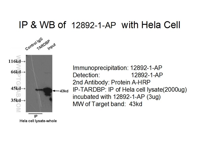 TARDBP IP 12892-1-AP TARDBP Antibody ALS10; TDP-43; Tdp43