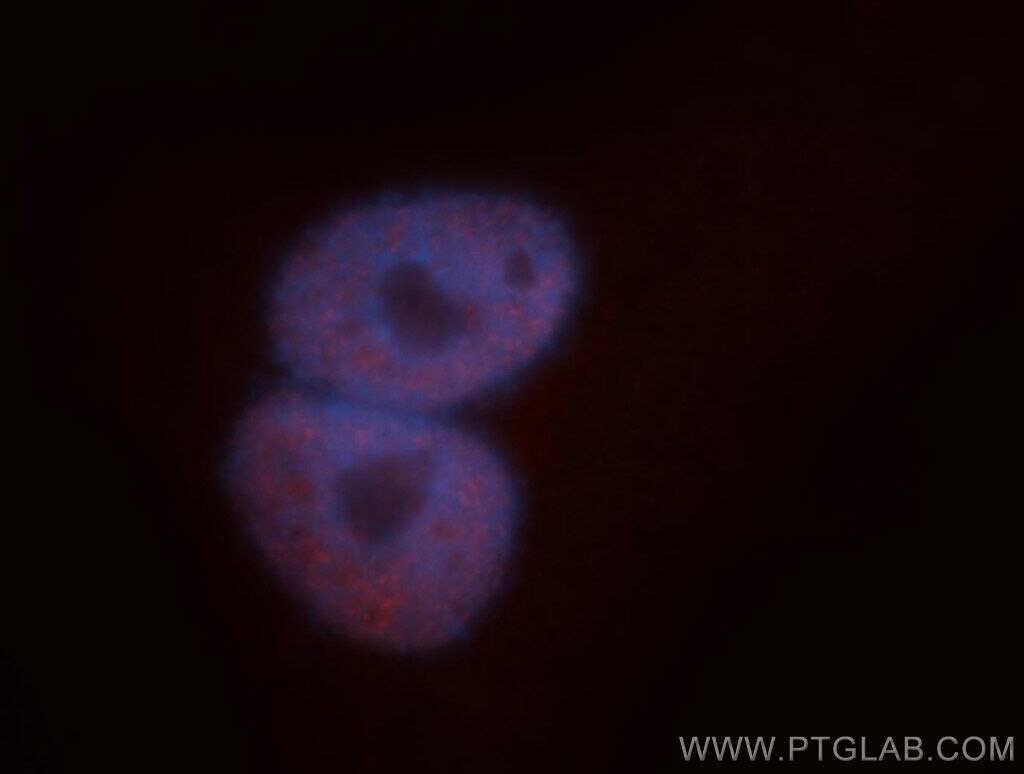 Immunofluorescent analysis of A549 cells, using TARDBP antibody 12892-1-AP at 1:50 dilution and Rhodamine-labeled goat anti-rabbit IgG (red). Blue pseudocolor = DAPI (fluorescent DNA dye). TARDBP Immunofluorescence IF 12892-1-AP TARDBP Antibody ALS10; TDP-43; Tdp43