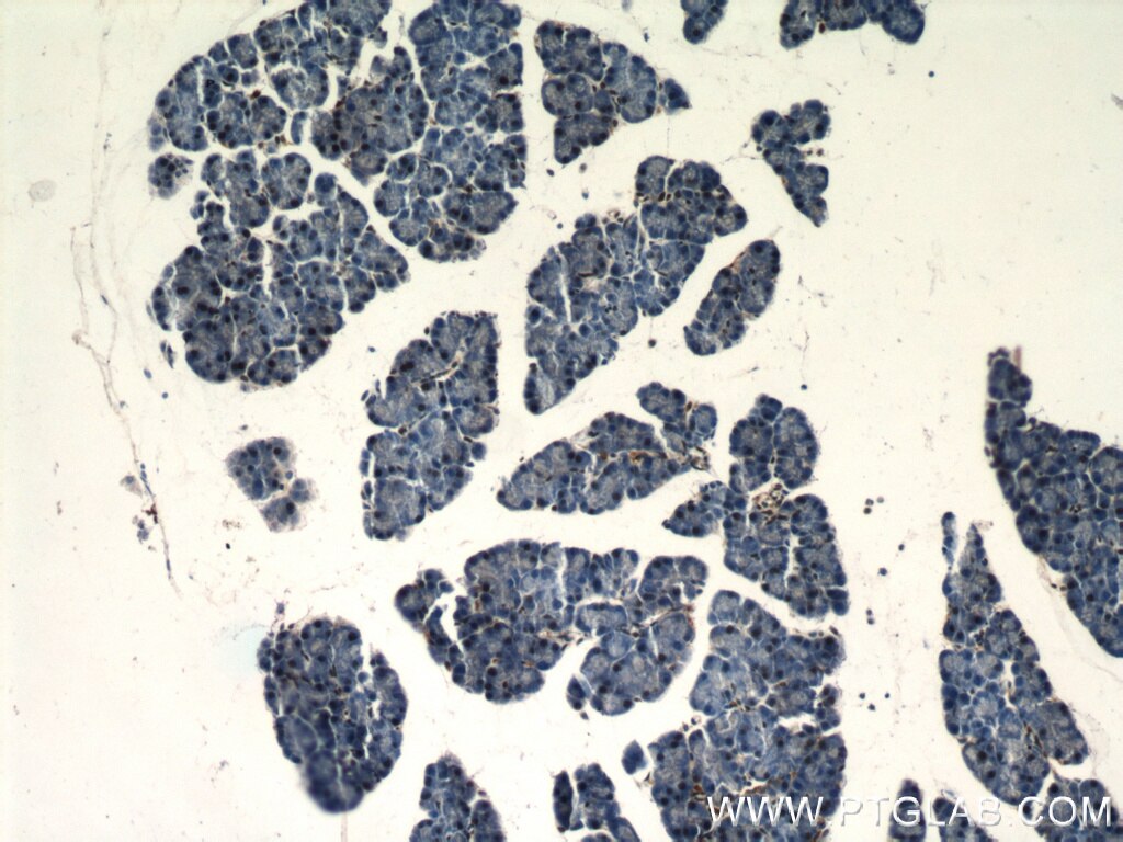Immunohistochemistry of paraffin-embedded mouse pancreas using TARDBP Antibody 12892-1-AP (under 10x lens) TARDBP IHC Immunohistochemistry 12892-1-AP TARDBP Antibody ALS10; TDP-43; Tdp43