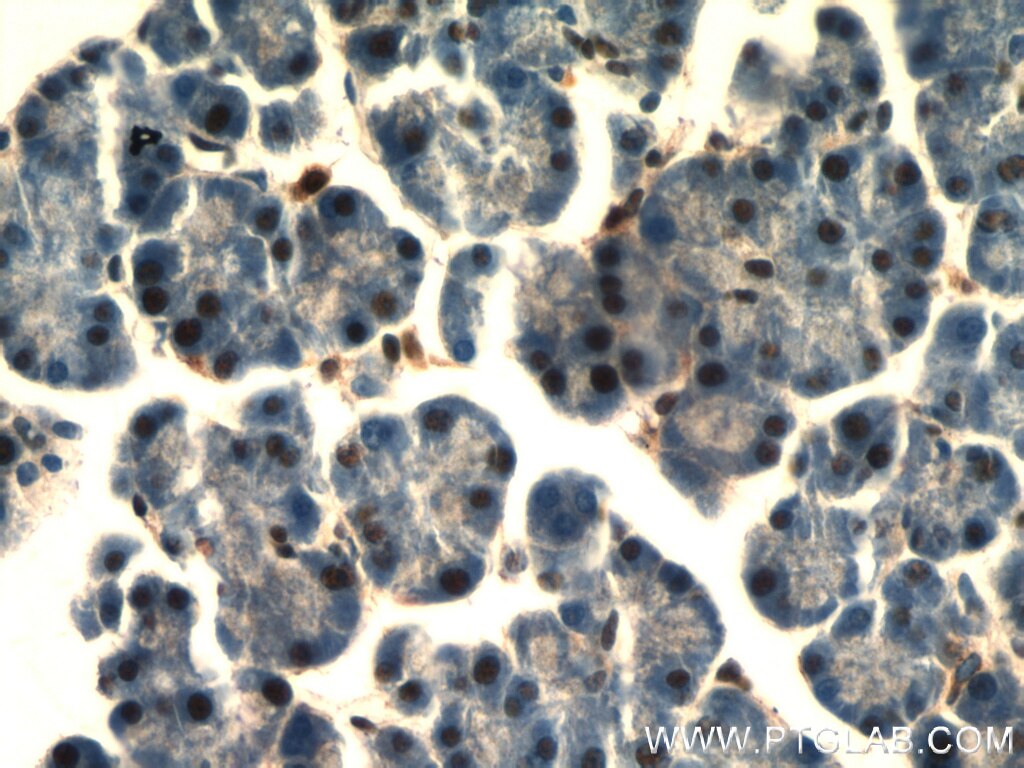 Immunohistochemistry of paraffin-embedded mouse pancreas using TARDBP Antibody 12892-1-AP (under 40x lens) TARDBP IHC Immunohistochemistry 12892-1-AP TARDBP Antibody ALS10; TDP-43; Tdp43