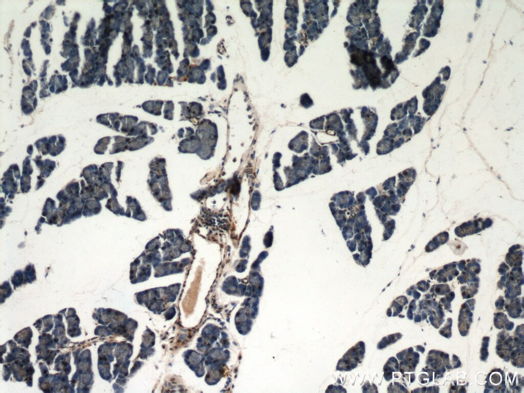Immunohistochemistry of paraffin-embedded mouse pancreas using TARDBP Antibody 12892-1-AP (under 10x lens) TARDBP IHC Immunohistochemistry 12892-1-AP TARDBP Antibody ALS10; TDP-43; Tdp43