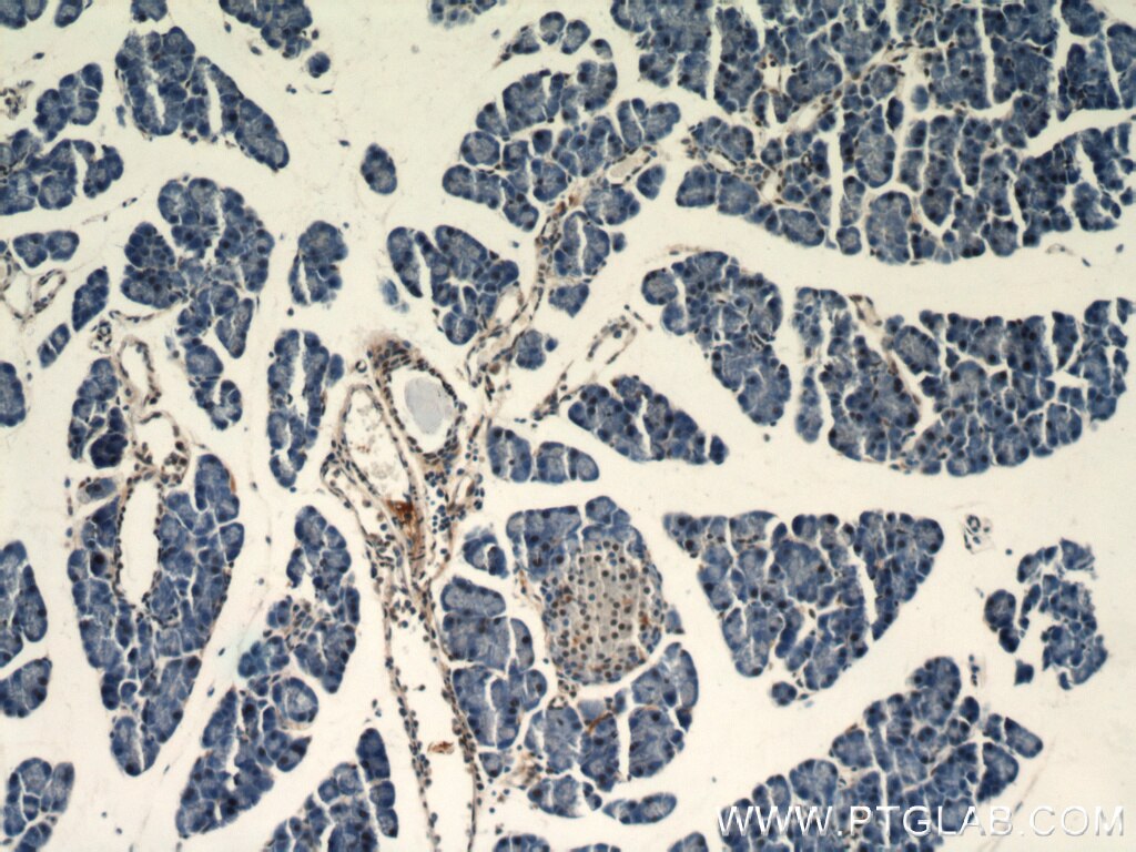 Immunohistochemistry of paraffin-embedded mouse pancreas using TARDBP Antibody 12892-1-AP (under 10x lens) TARDBP IHC Immunohistochemistry 12892-1-AP TARDBP Antibody ALS10; TDP-43; Tdp43