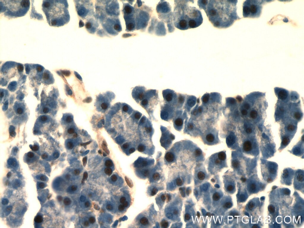 Immunohistochemistry of paraffin-embedded mouse pancreas using TARDBP Antibody 12892-1-AP (under 40x lens) TARDBP IHC Immunohistochemistry 12892-1-AP TARDBP Antibody ALS10; TDP-43; Tdp43