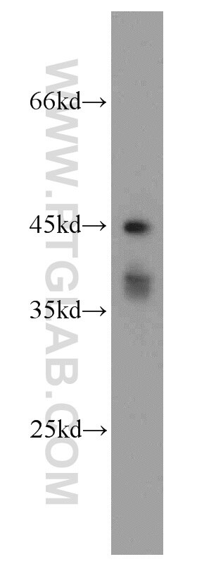 mouse pancreas tissue were subjected to SDS PAGE followed by western blot with TARDBP Antibody 12892-1-AP TARDBP western blot WB 12892-1-AP TARDBP Antibody ALS10; TDP-43; Tdp43