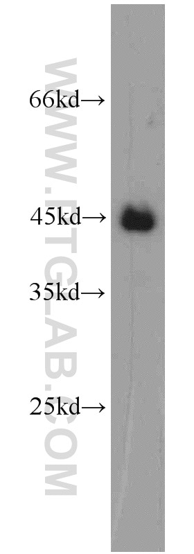 A2780 cells were subjected to SDS PAGE followed by western blot with TARDBP Antibody 12892-1-AP TARDBP western blot WB 12892-1-AP TARDBP Antibody ALS10; TDP-43; Tdp43