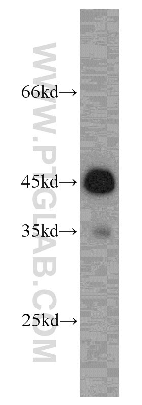 HeLa cells were subjected to SDS PAGE followed by western blot with TARDBP Antibody 12892-1-AP TARDBP western blot WB 12892-1-AP TARDBP Antibody ALS10; TDP-43; Tdp43