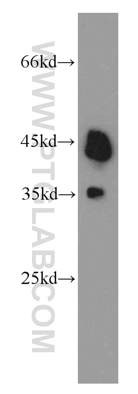 mouse heart tissue were subjected to SDS PAGE followed by western blot with TARDBP Antibody 12892-1-AP TARDBP western blot WB 12892-1-AP TARDBP Antibody ALS10; TDP-43; Tdp43