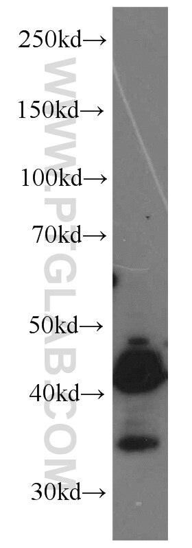 HeLa cells were subjected to SDS PAGE followed by western blot with TARDBP Antibody 12892-1-AP TARDBP western blot WB 12892-1-AP TARDBP Antibody ALS10; TDP-43; Tdp43