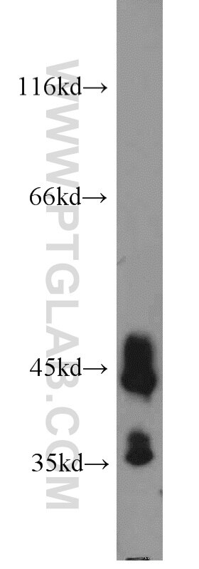 mouse heart tissue were subjected to SDS PAGE followed by western blot with TARDBP Antibody 12892-1-AP TARDBP western blot WB 12892-1-AP TARDBP Antibody ALS10; TDP-43; Tdp43