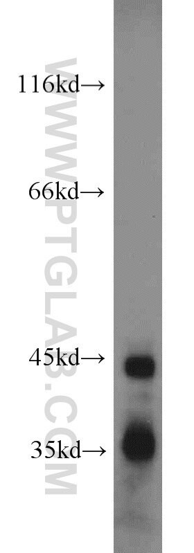mouse pancreas tissue were subjected to SDS PAGE followed by western blot with TARDBP Antibody 12892-1-AP TARDBP western blot WB 12892-1-AP TARDBP Antibody ALS10; TDP-43; Tdp43