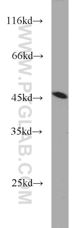 human placenta tissue were subjected to SDS PAGE followed by western blot with TARDBP Antibody 12892-1-AP TARDBP western blot WB 12892-1-AP TARDBP Antibody ALS10; TDP-43; Tdp43
