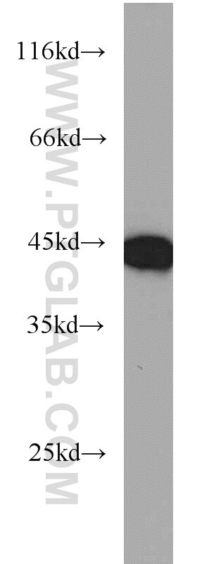 K-562 cells were subjected to SDS PAGE followed by western blot with TARDBP Antibody 12892-1-AP TARDBP western blot WB 12892-1-AP TARDBP Antibody ALS10; TDP-43; Tdp43
