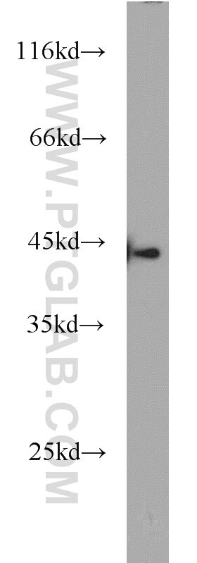 K-562 cells were subjected to SDS PAGE followed by western blot with TARDBP Antibody 12892-1-AP TARDBP western blot WB 12892-1-AP TARDBP Antibody ALS10; TDP-43; Tdp43