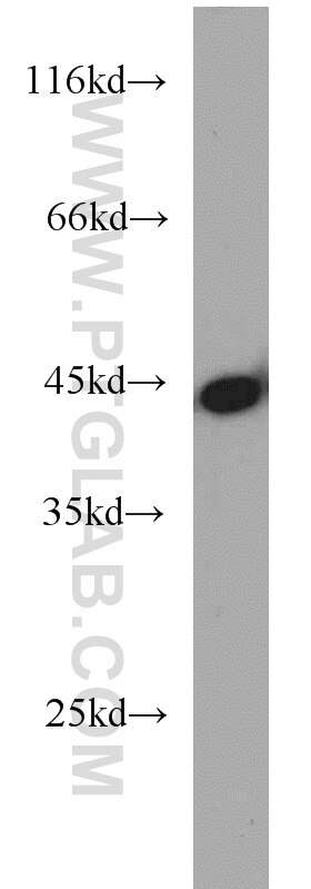 K-562 cells were subjected to SDS PAGE followed by western blot with TARDBP Antibody 12892-1-AP TARDBP western blot WB 12892-1-AP TARDBP Antibody ALS10; TDP-43; Tdp43