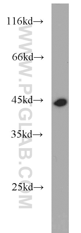 K-562 cells were subjected to SDS PAGE followed by western blot with TARDBP Antibody 12892-1-AP TARDBP western blot WB 12892-1-AP TARDBP Antibody ALS10; TDP-43; Tdp43